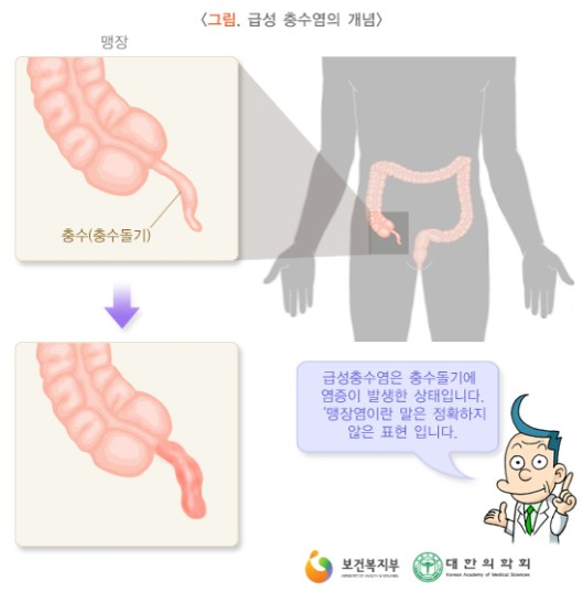 이미지명
